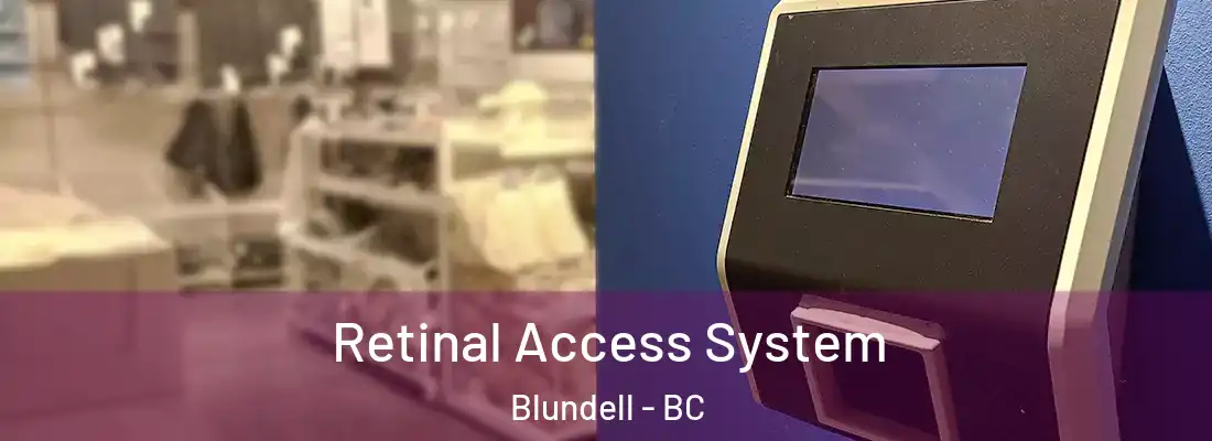  Retinal Access System Blundell - BC